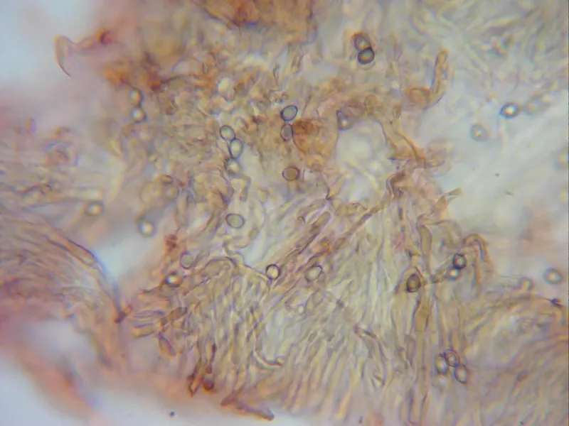 Chlorophyllum molybdites 39 -Pileipellis escamas x 400